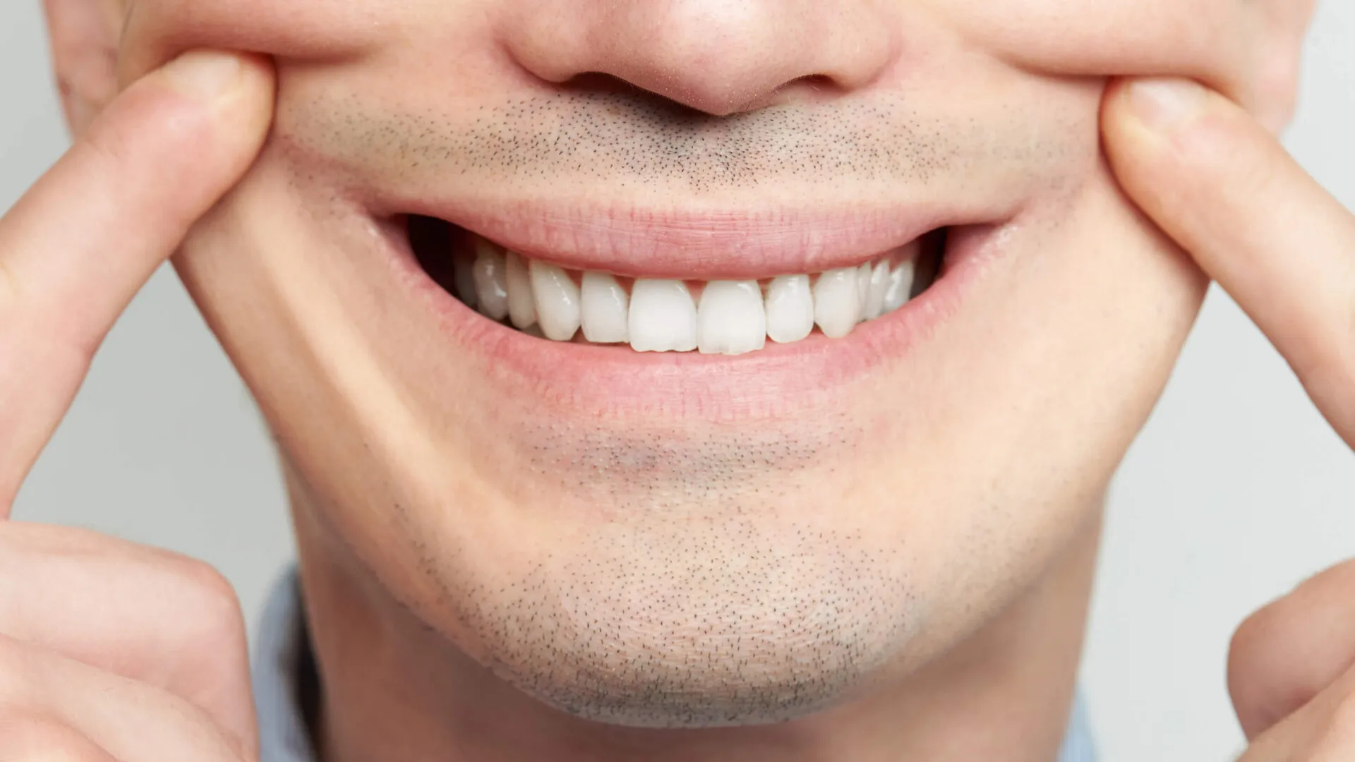 Close-up of a straight white smile with hands framing the face