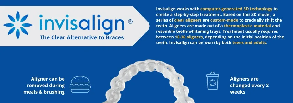 Invisalign infographic describing the clear alternative to braces and how the aligners are worn and changed