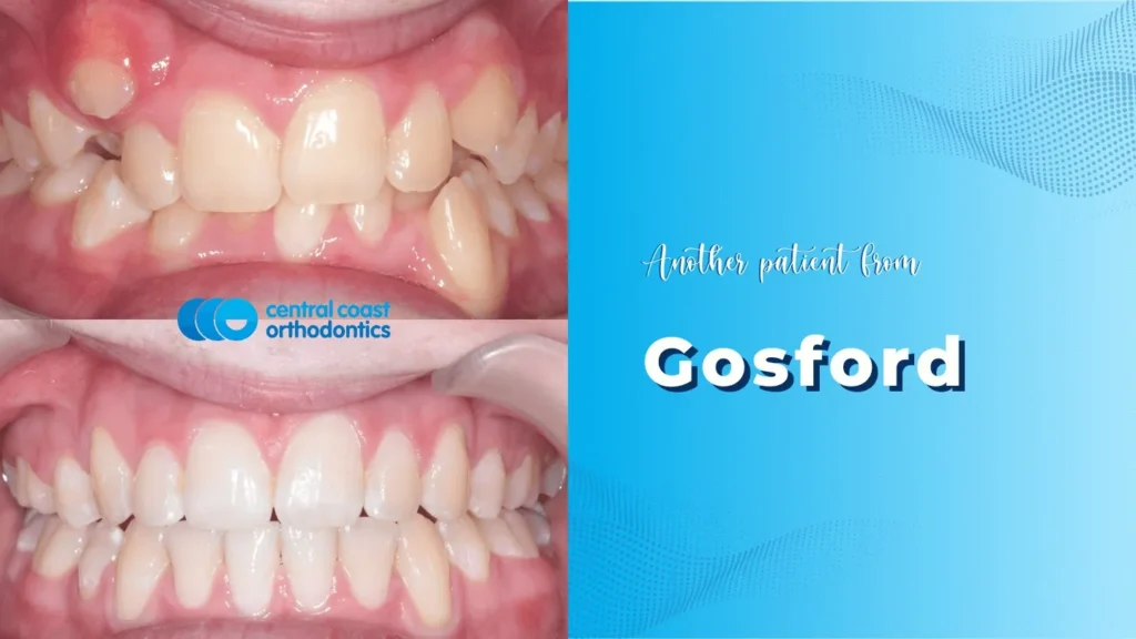 Patient Journey in Gosford