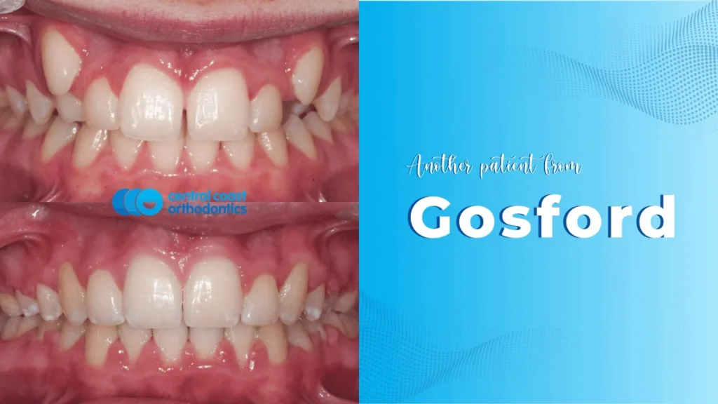 CCO Patient 3