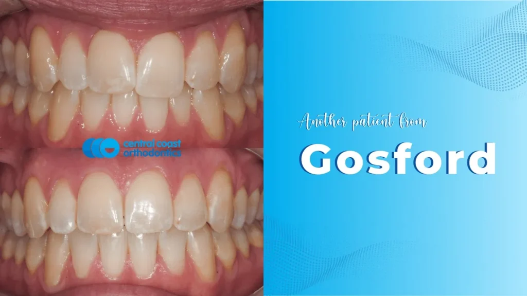 CCO Patient 2