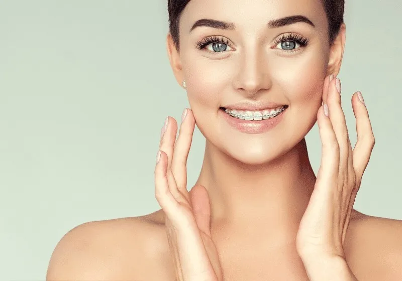 Braces vs Aligners – Which Will Suit You Better? Orthodontics Articles