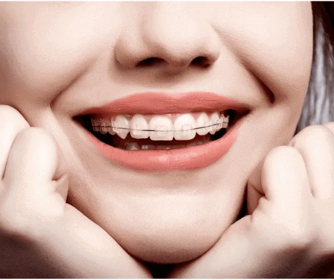 Metal Braces Does This Traditional Dental Technology Have a Future