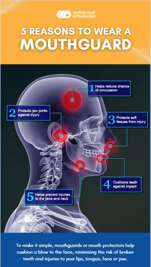 Infographic titled 5 Reasons to Wear a Mouthguard, showing a head diagram with the jaw, teeth, lips and neck marked as the areas a mouthguard protects