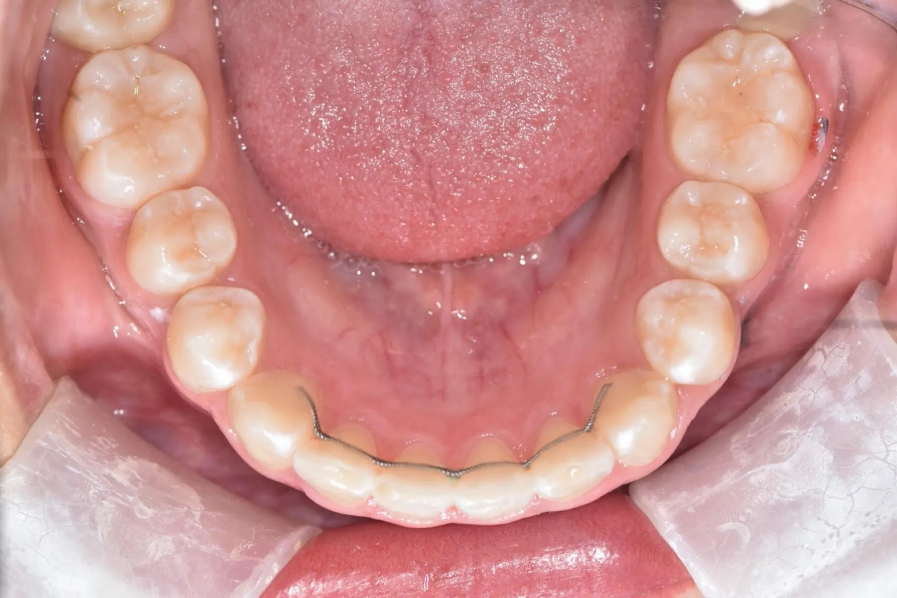 Lower teeth viewed from above
