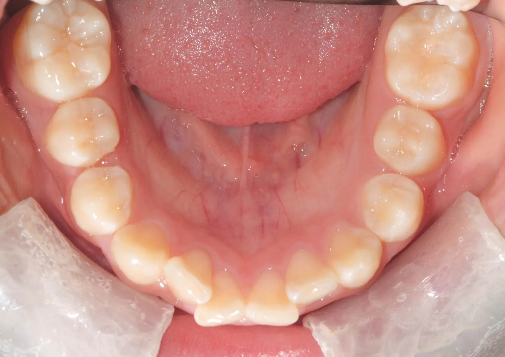 Lower teeth viewed from above