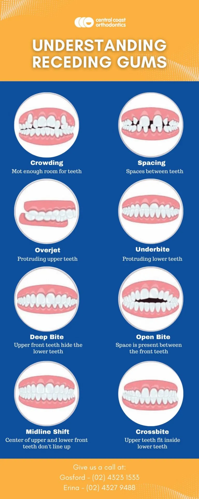 Infographic showing eight types of malocclusion: crowding, spacing, overjet, underbite, deep bite, open bite, midline shift and crossbite