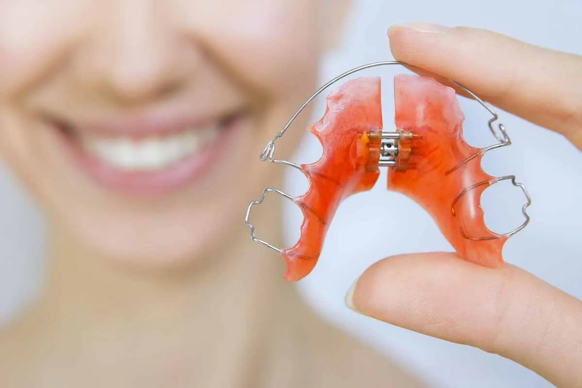 Hand holding an orange removable orthodontic plate with a retaining wire