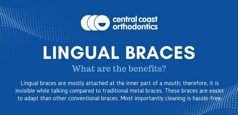 Banner reading Lingual Braces, what are the benefits, explaining braces fitted behind the teeth