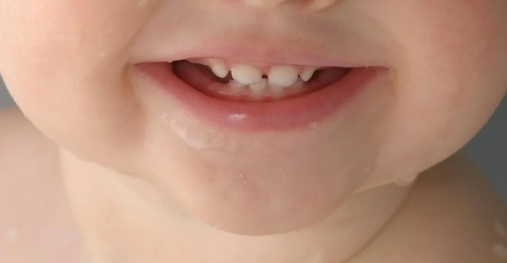 Close-up of a young child's smile with baby teeth