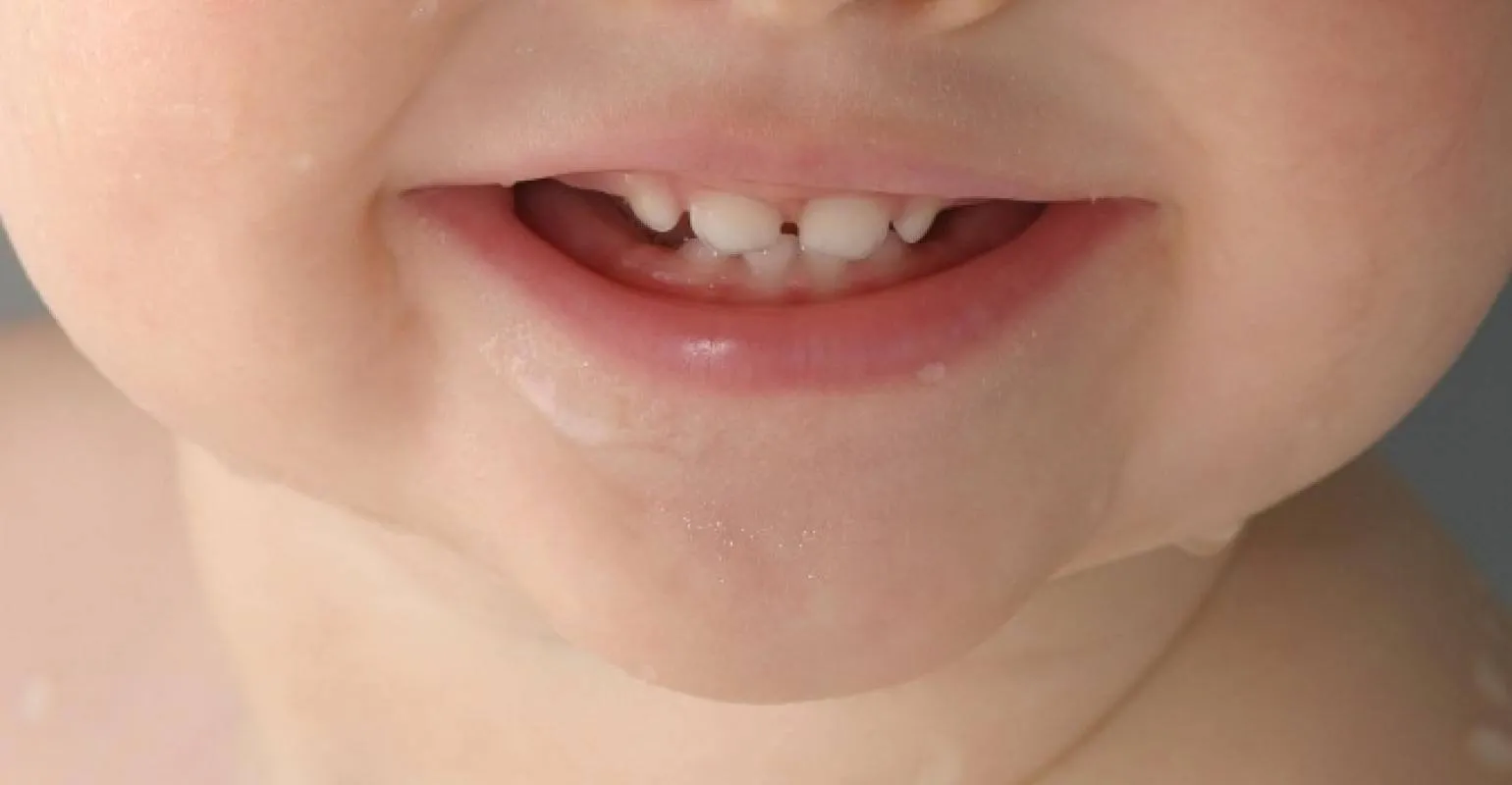 Close-up of a young child's smile with baby teeth