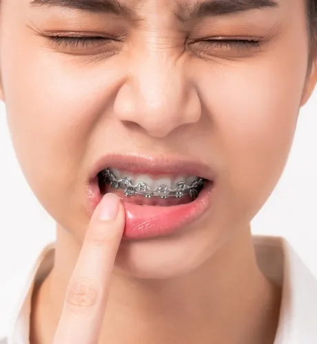 Prepare for Discomfort in your Braces at Central Coast Orthodontics in Gosford, Erina, Central Coast