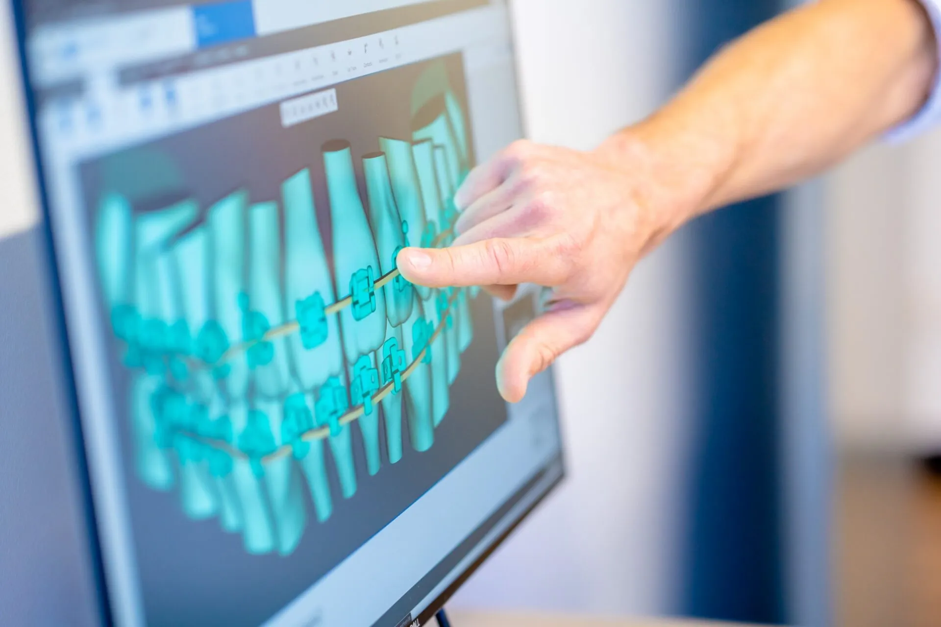 How Long Does Orthodontic Treatment Usually Take? At Central Coast Orthodontics In Gosford, Erina, Central Coast