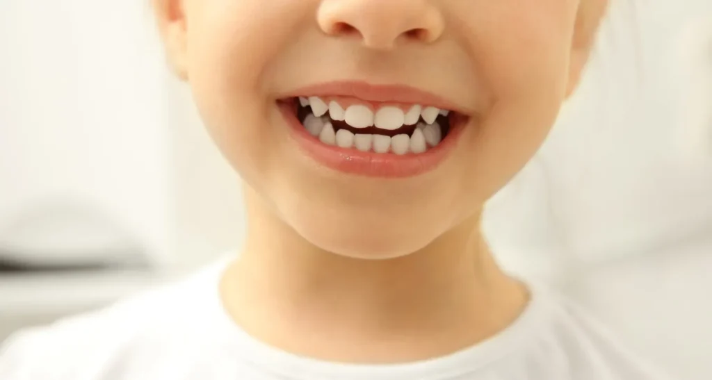 Smart Approach to Phased Orthodontic Treatment