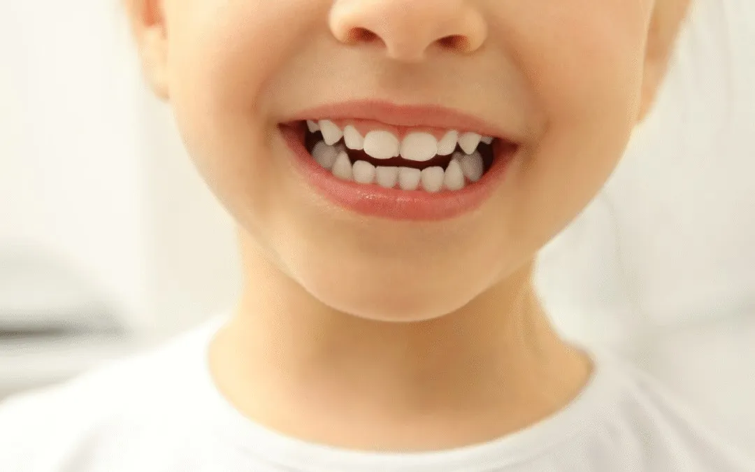 Starting Early, Finishing Strong The Smart Approach to Phased Orthodontic Treatment At Central Coast Orthodontics In Gosford, Erina, Central Coast