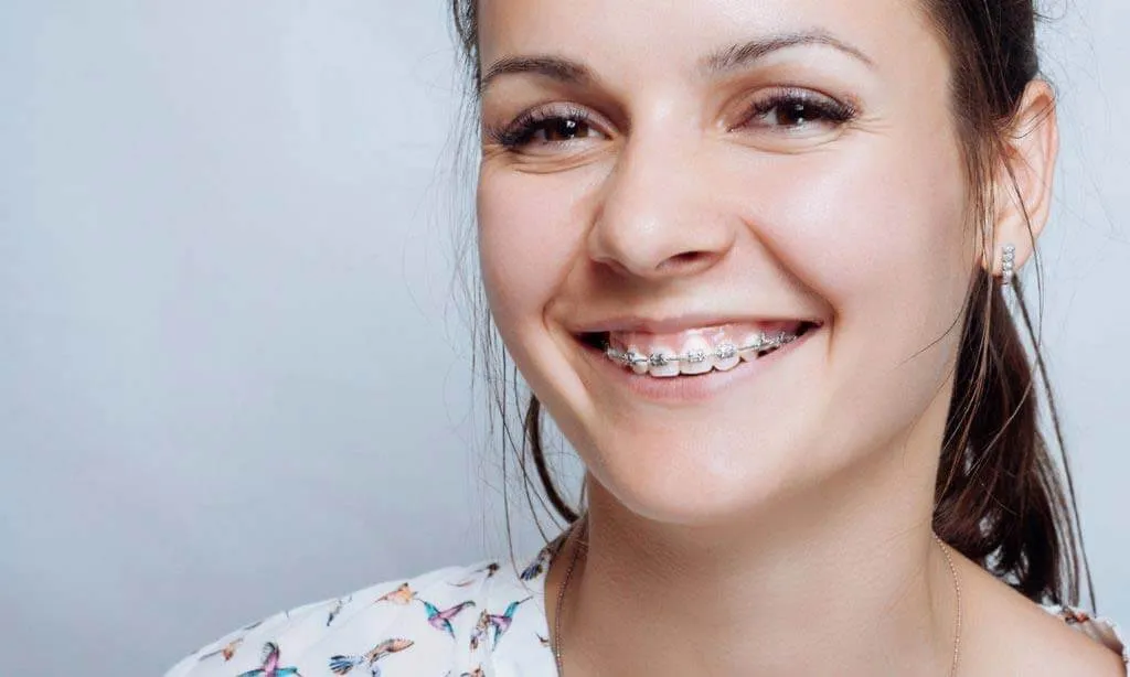 Young woman with braces smiling