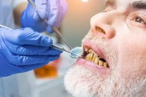 Gloved clinician examining an older man's teeth with a mirror and probe