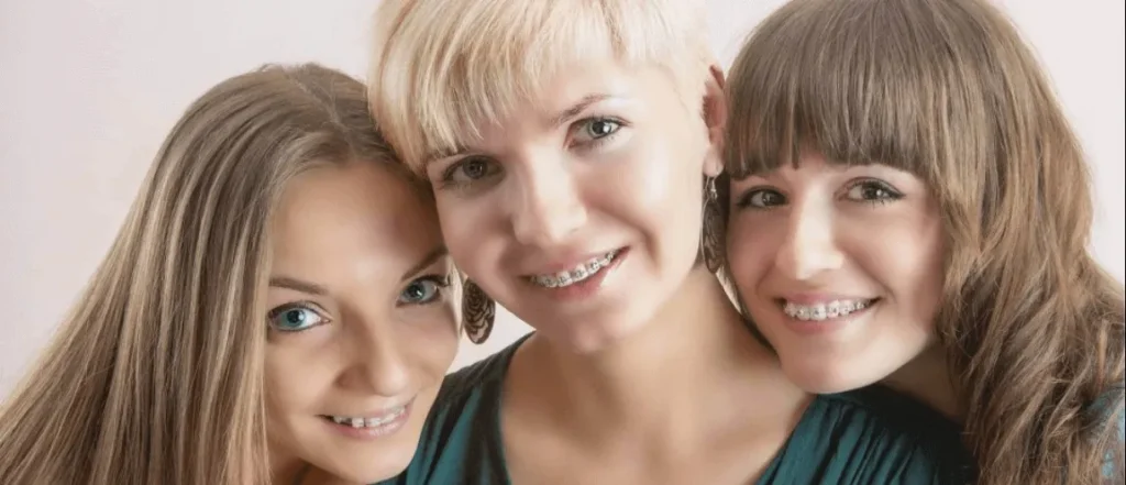Three girls smiling together, two of them wearing braces